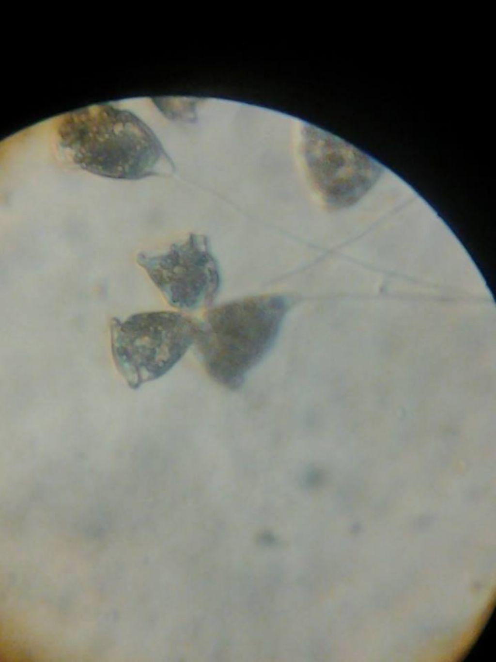 vorticella?